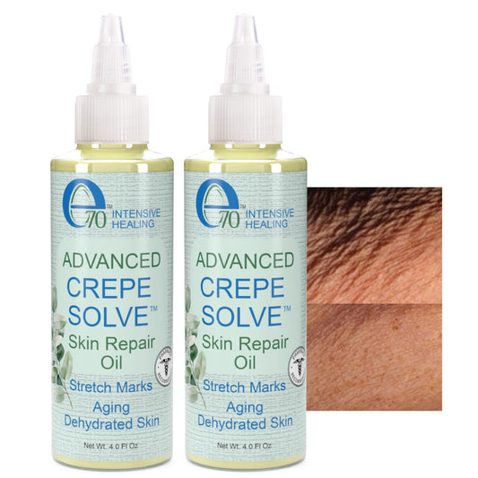 Advanced Crepe Solve Skin Repair Oil – Stretch Marks and Crepey Skin Treatment – Face and Body Oil for All Skin Types – 4Oz (Pack of 2)