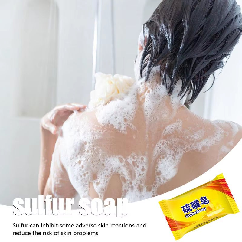 Cleaner Bar Soap Body Soap Bar Shanghai Sulfur Soap Bar Natural Facial Cleanser Soap Face Washing Bathing and Foot Washing Soap